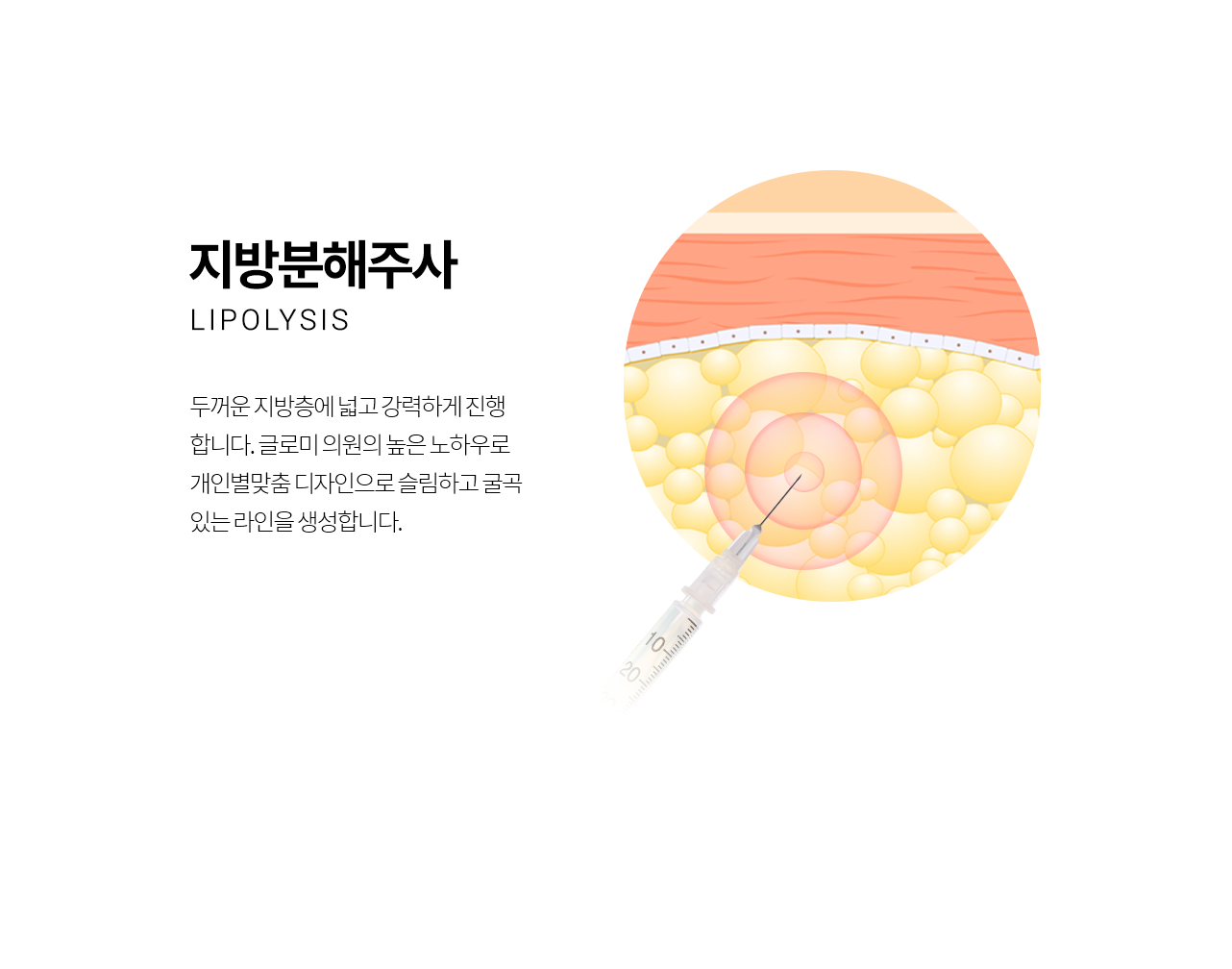 +SLIM 근육 보톡스 톡톡 줄어드는 근육 - 사각턱/바디의 근육에 주사하여 두께와 부피를 줄여 슬림한 라인을 만듭니다.